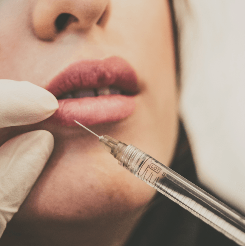 Dermal Filler